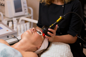 Age Attraction lézeres mezoterápia (Meso Laser) 